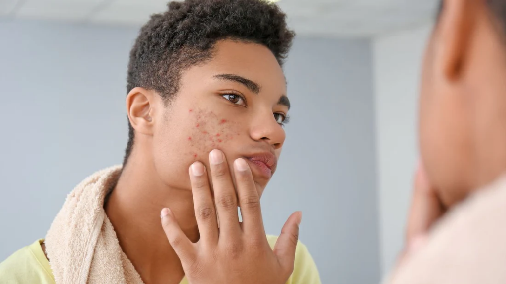 Poivre de Guinée pour Soulager les fibromes utérins